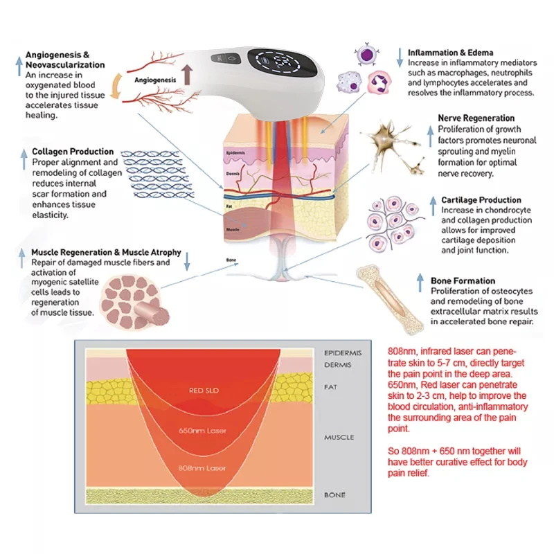 Body pain laser therapy device