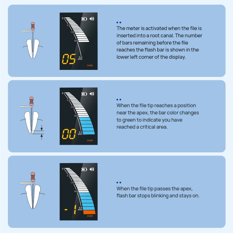 Locator Zahnmedizin Endodontie