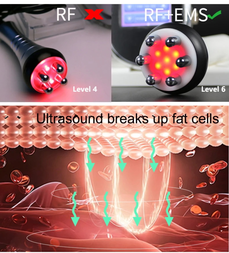 40K Ultrasonic Cavitation Machine