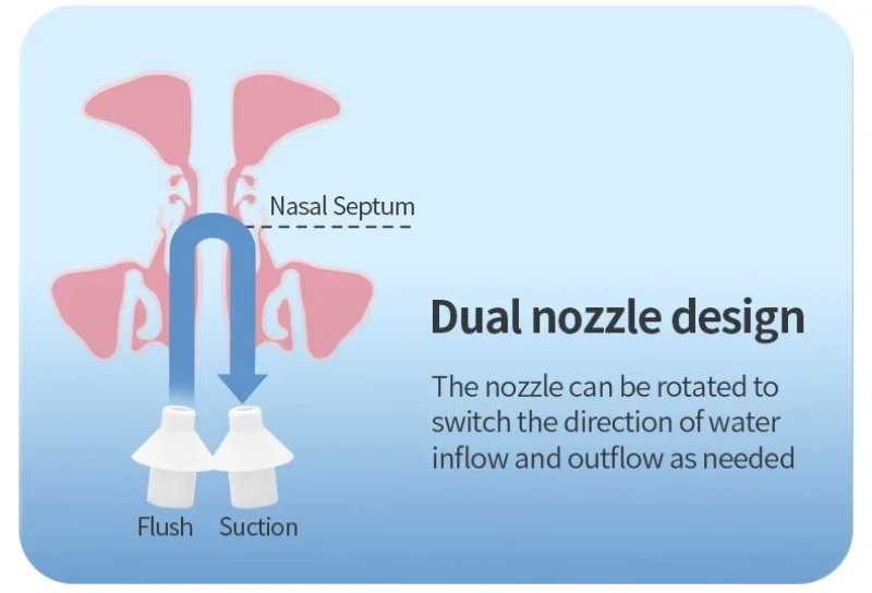 rhinitis treatment