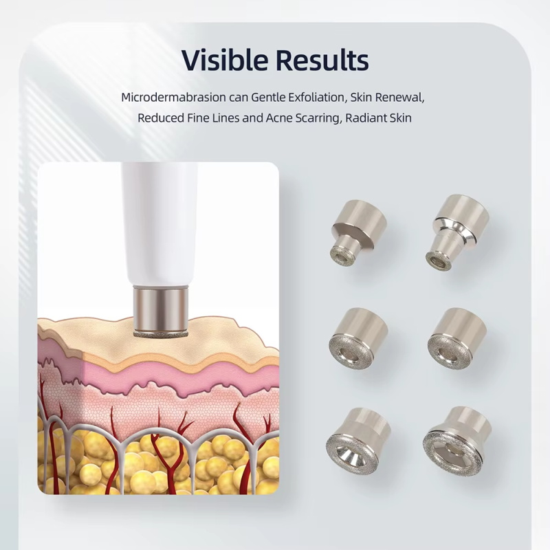 Diamant-Mikro derma brasions maschine