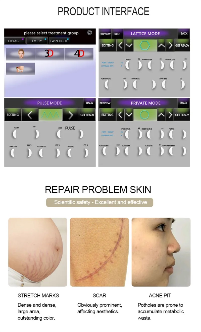 CO2 fractional laser wrinkle removal stretch mark removal machine