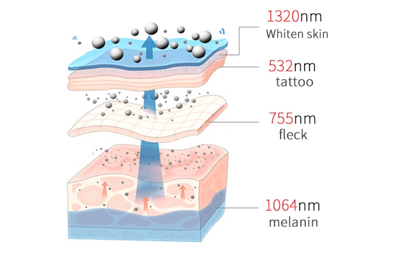 Picosecond laser tattoo removal machine