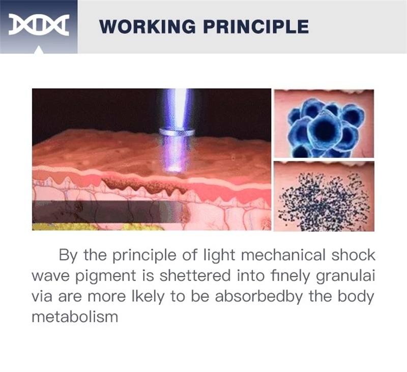 Pikosekunden-Laser-Tattoo entfernungs maschine