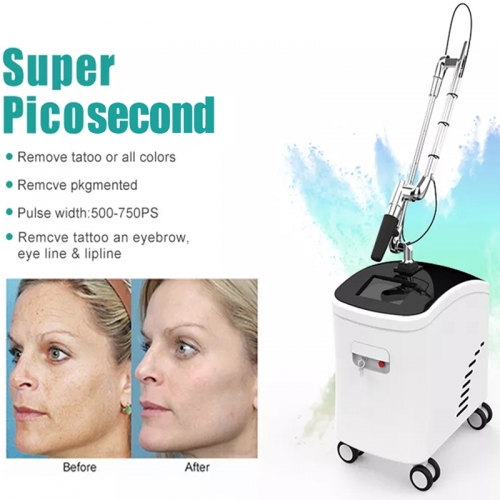 Super Picosecond Removal of Melanin Tattoo Removal 532nm 755nm 1064nm Whitening and Tender Skin Machine Beauty Salon