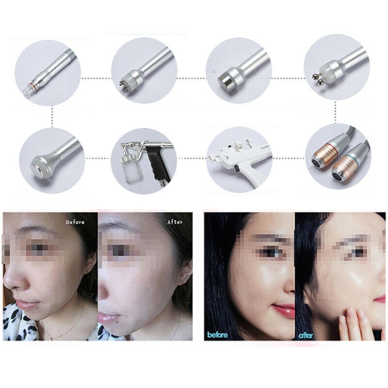 11 in 1 Bio-Lifting Spa facial machine