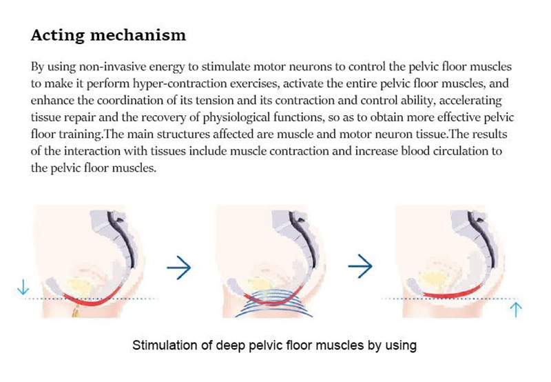 EMS pelvic floor muscle trainer