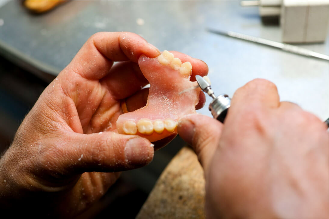 Best Tools and Tips for Polishing Acrylic Dentures