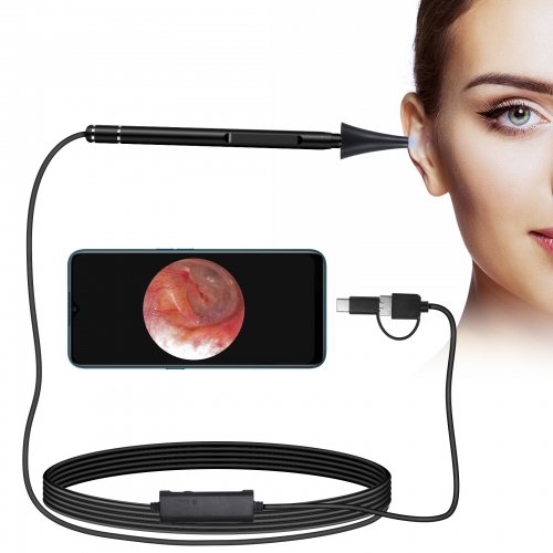 Nettoyage de l'oreille endoscope USB WiFi Mini caméra Visual