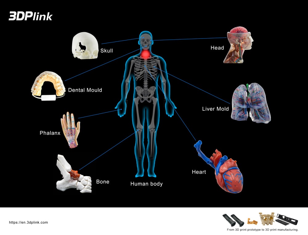 Application cases of 3D printing in the medical industry