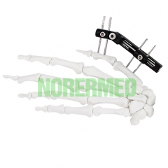 Mini Fragment External Fixator (Finger and Palm)- ...