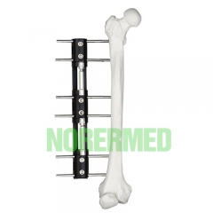 Bone Lengthening External Fixator – Type A