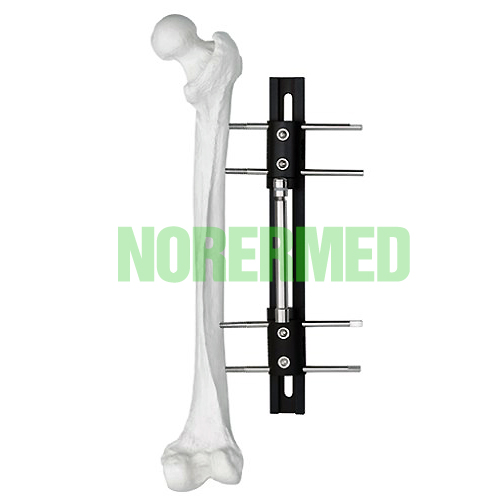 Bone Lengthening External Fixator – Type B