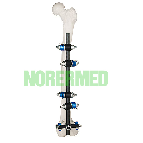 Orthopedic T frame Femur & Tibial External Fixator