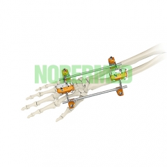 Orthopedic Hoffmann Ulna & Radius External Fixator