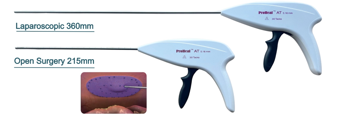 Absorbable Mesh Fixation Device