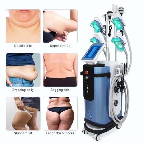 Nueva actualización de la máquina de congelación de grasa criogénica Cryolipolysis 360 Máquina de congelación de criolipólisis