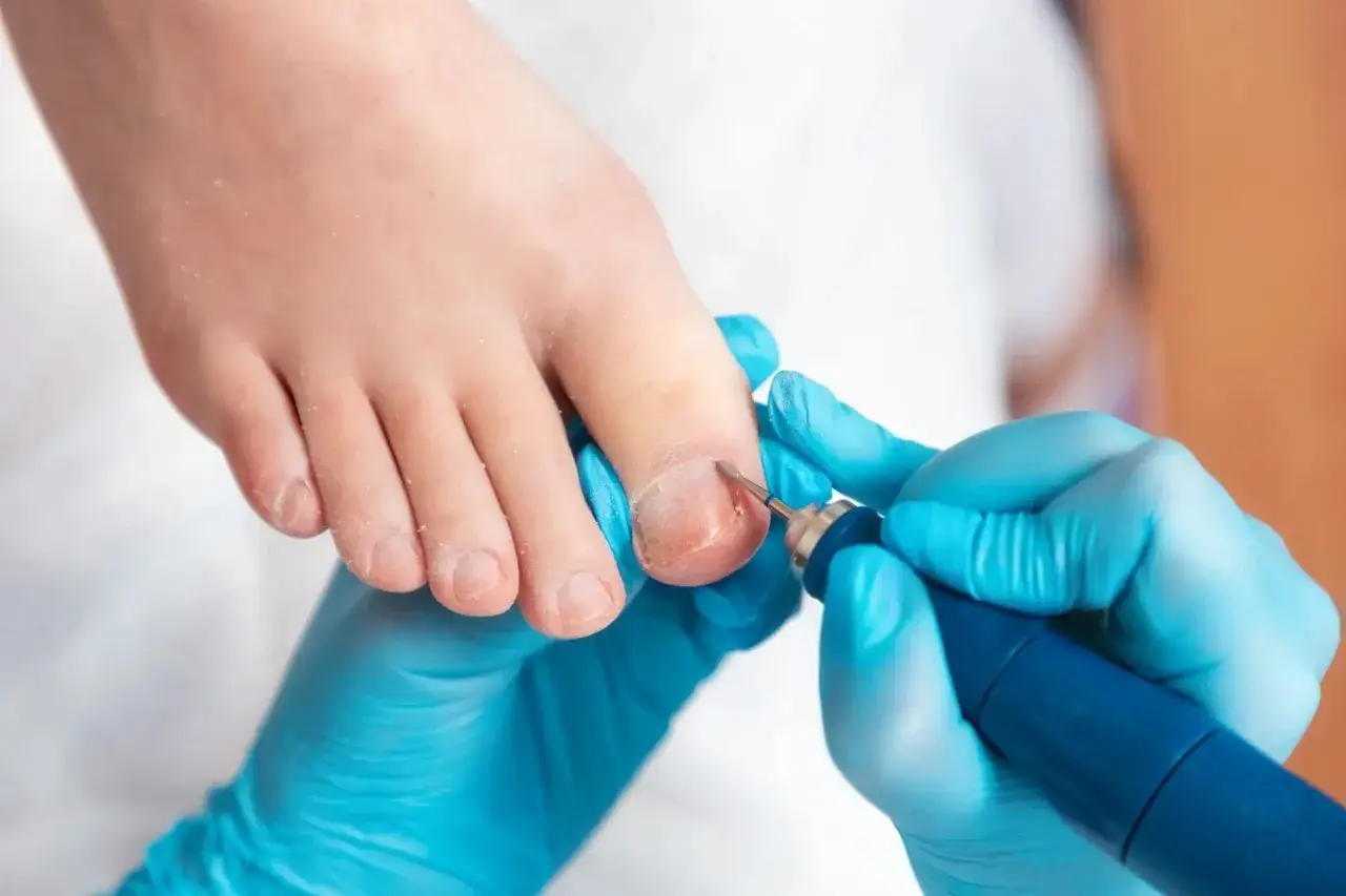 How to Thin Thick Toenails with a Professional Nail Drill