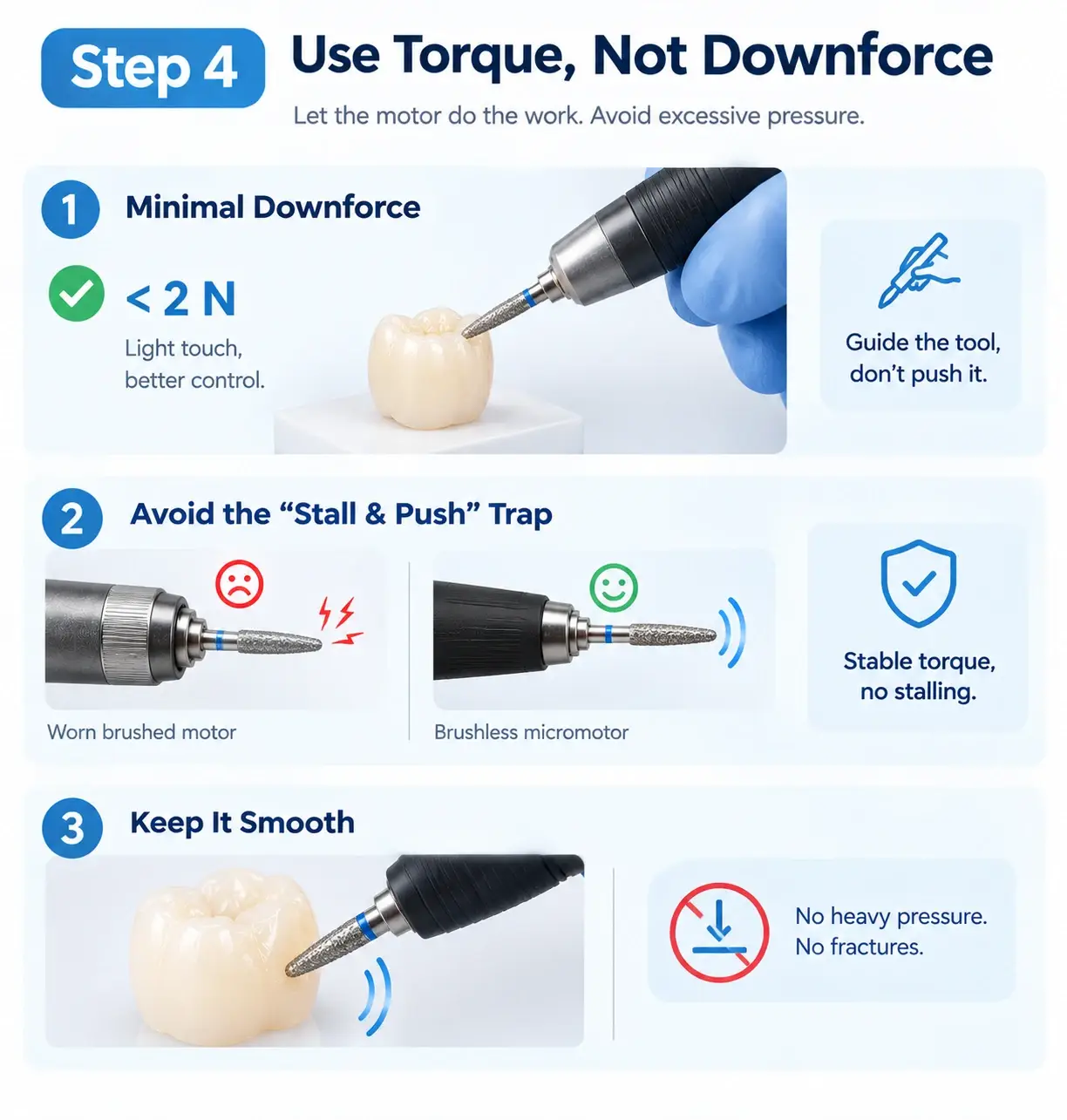 Illustration of using brushless micromotor torque with minimal downforce to prevent crown chipping
