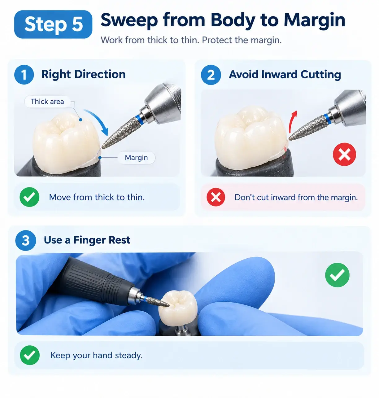 Proper grinding technique sweeping bur from body to margin with a stable finger rest
