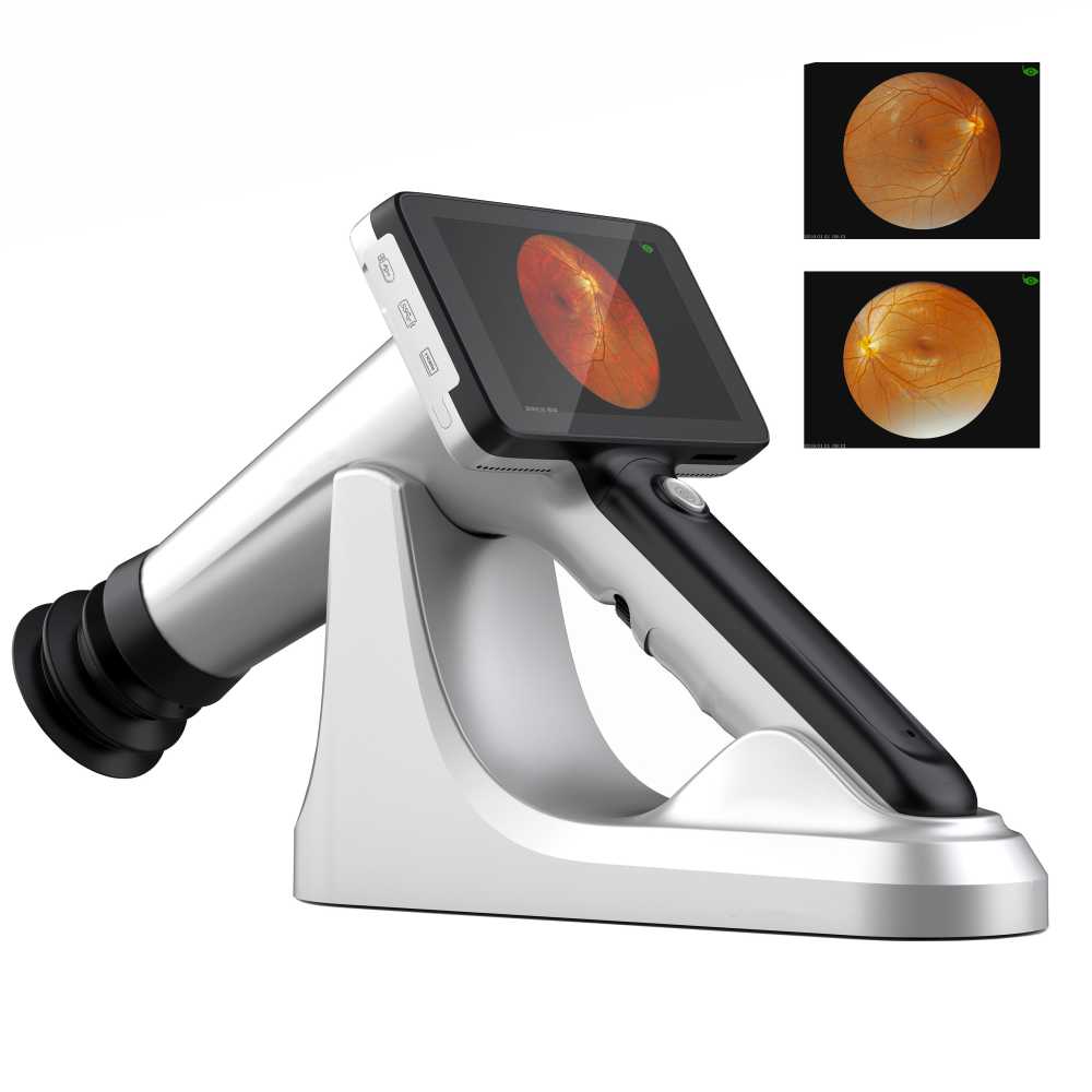 ophthalmology instrument Top Quality Hand Held Digital Fundus Camera for sale