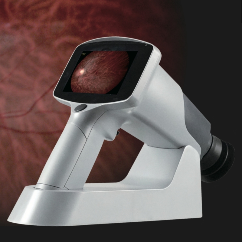 China top quality ophthalmic equipment Portable Fundus Camera cheap price handheld fundus photography