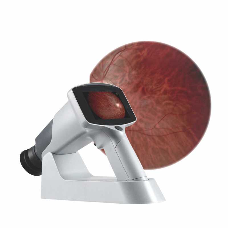 China top quality ophthalmic equipment Portable Fundus Camera cheap price handheld fundus photography