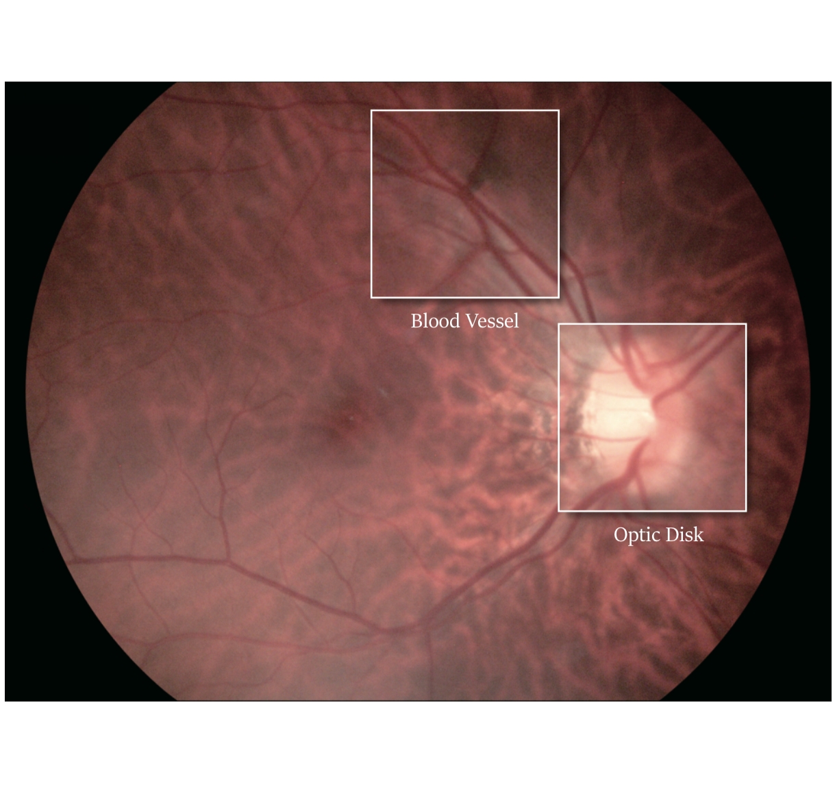 China top quality ophthalmic equipment Portable Fundus Camera cheap price handheld fundus photography