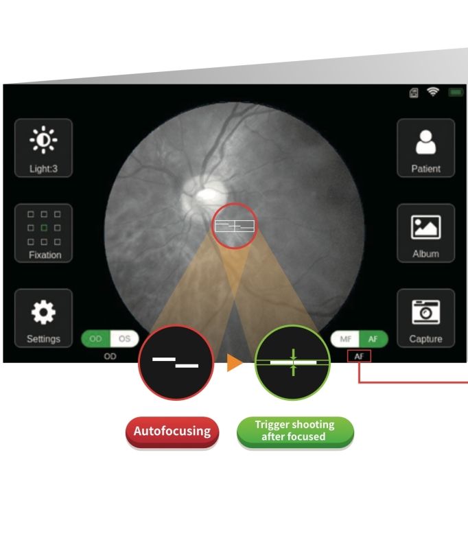 China top quality ophthalmic equipment Portable Fundus Camera cheap price handheld fundus photography