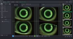 Chinese ophthalmology slit lamp microscope topcon LED High Quality digital portable slit lamp