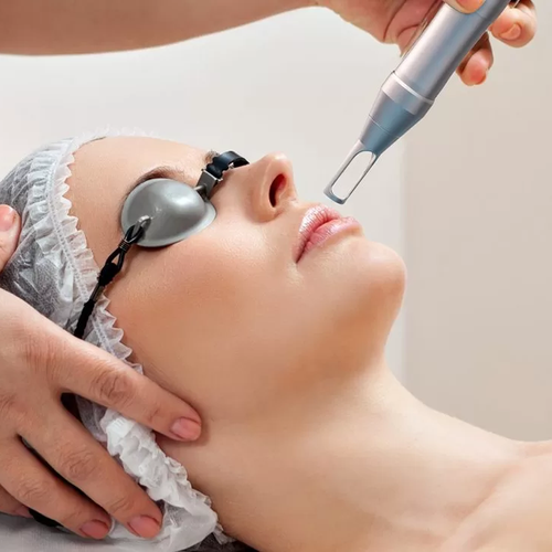 Complete Solution for High Minimum Energy on Q-Switched Nd Laser: Managing Excessive Pain & Post-Inflammatory Hyperpigmentation (PIH)