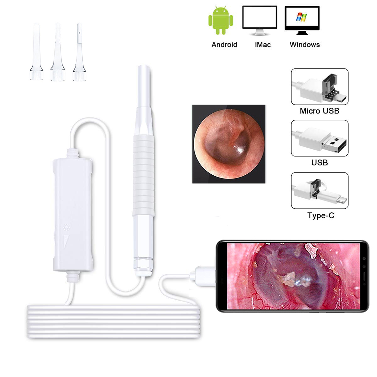 Mini Otoscope Oreille, Bysameyee Grossissement Diagnostic