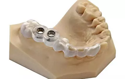 Dental Market Will Be a Future Industry with Integrating 3D Digital Products