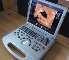 Laptop Color Doppler Ultrasound Scanner