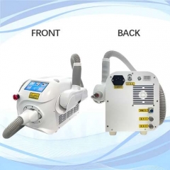 laser tattoo removal machine