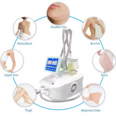 Portable cryolipolysis for fat removal and slimming
