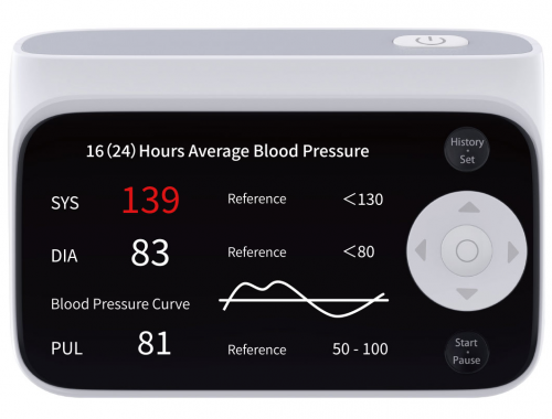 AOJ-33K智能动态血压监测仪（ABPM）