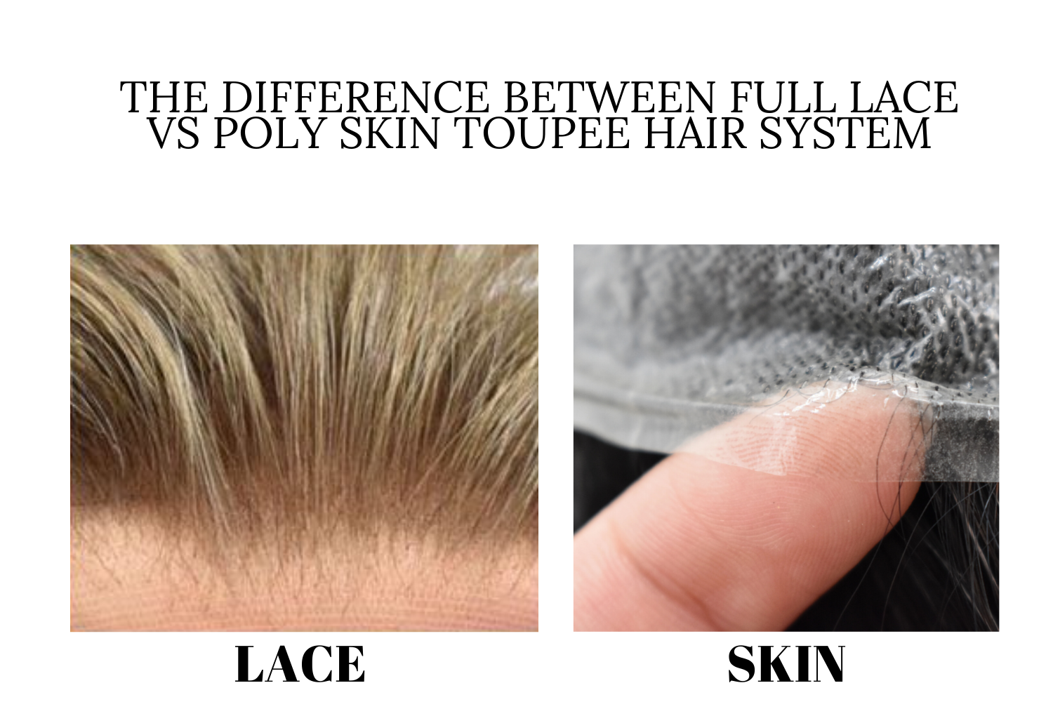 knot bleaching the front lace a Natural 100% Undetectable Hairline. 