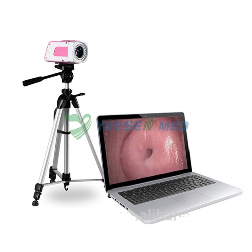 Portable Digital Colposcope YSSW3301