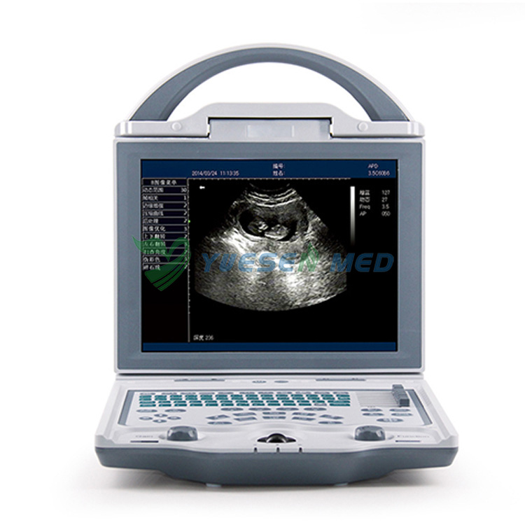 Machine à ultrasons portable YSB580 et scanner ultra-son pour