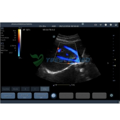 Palm Wireless color ultrasound system YSB363