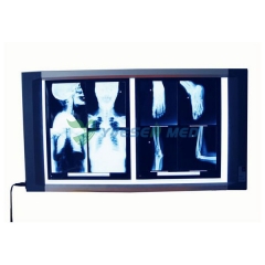 Luxury X ray film viewer YSX1705