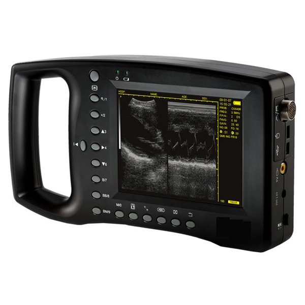 Escáner de ultrasonido portátil Ddigital YSB3100