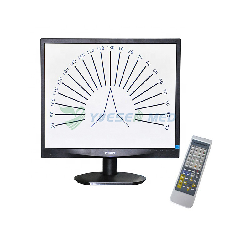 Monitor Chart