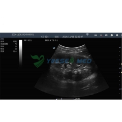 Wireless color ultrasound system