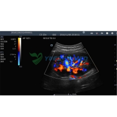 Wireless color ultrasound system
