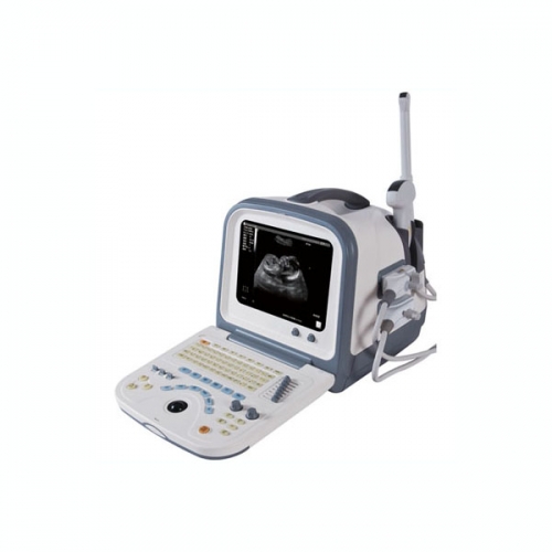 Portable Ultrasound Machine for Home Use