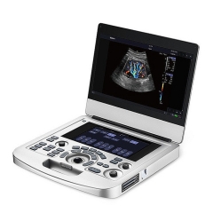 Máquina de ultrassom doppler colorido portátil Acclarix AX2 Edan