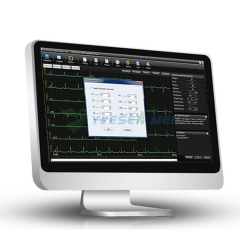 EDAN SE-1515 سعر المصنع آلة تخطيط القلب اللاسلكي للكمبيوتر الشخصي
