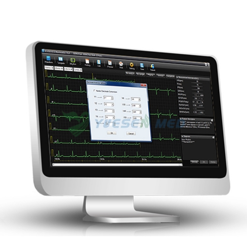 Máquina de ECG inalámbrica basada en PC del precio de fábrica EDAN SE-1515